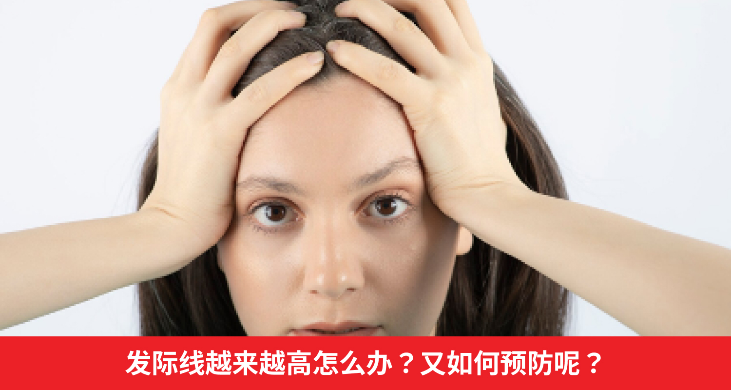 发际线越来越高怎么办？又如何预防呢？